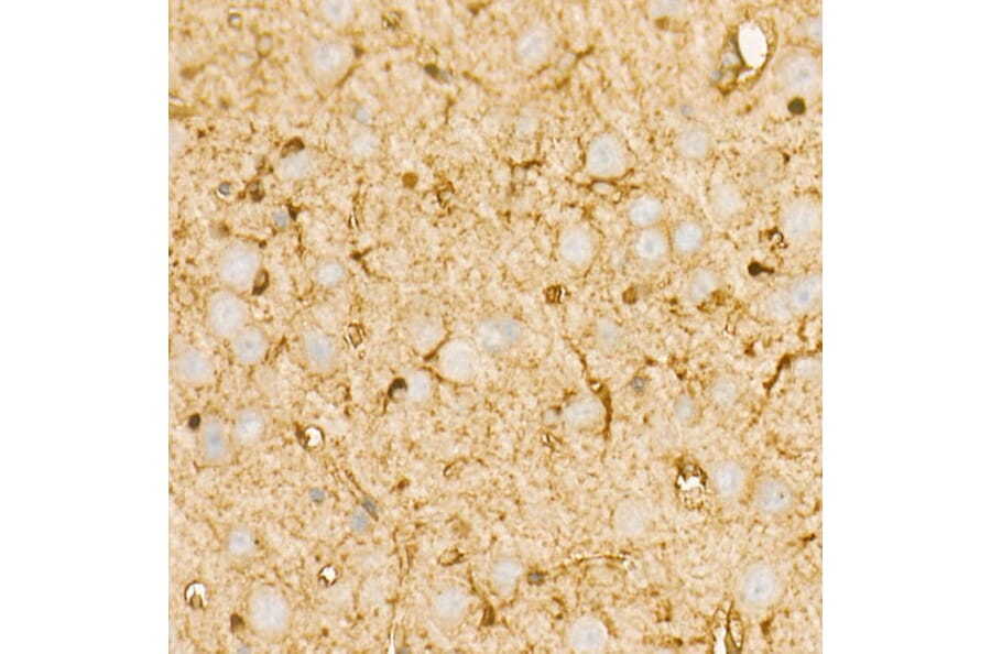 Immunohistochemistry - Anti-PI 3 Kinase p85 alpha Antibody [ARC55272] (A307709) - Antibodies.com