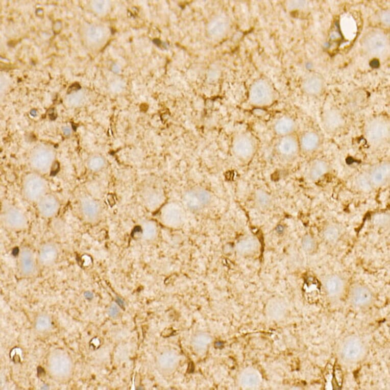 Immunohistochemistry - Anti-PI 3 Kinase p85 alpha Antibody [ARC55272] (A307709) - Antibodies.com