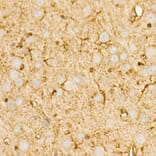 Immunohistochemistry - Anti-PI 3 Kinase p85 alpha Antibody [ARC55272] (A307709) - Antibodies.com
