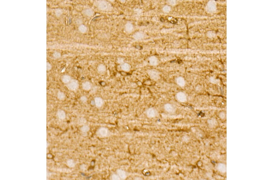 Immunohistochemistry - Anti-PI 3 Kinase p85 alpha Antibody [ARC55272] (A307709) - Antibodies.com