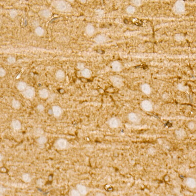 Immunohistochemistry - Anti-PI 3 Kinase p85 alpha Antibody [ARC55272] (A307709) - Antibodies.com