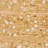 Immunohistochemistry - Anti-PI 3 Kinase p85 alpha Antibody [ARC55272] (A307709) - Antibodies.com