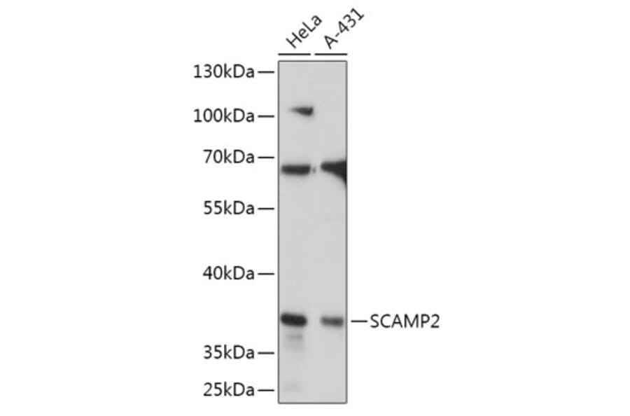 Western Blot - Anti-SCAMP2/SC2 Antibody (A307710) - Antibodies.com