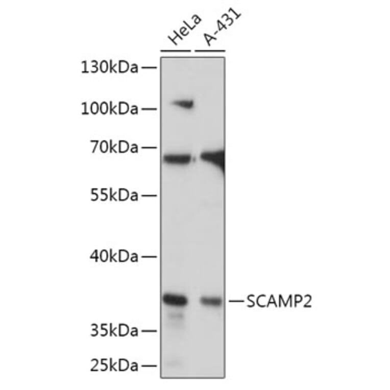 Western Blot - Anti-SCAMP2/SC2 Antibody (A307710) - Antibodies.com