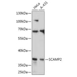 Western Blot - Anti-SCAMP2/SC2 Antibody (A307710) - Antibodies.com