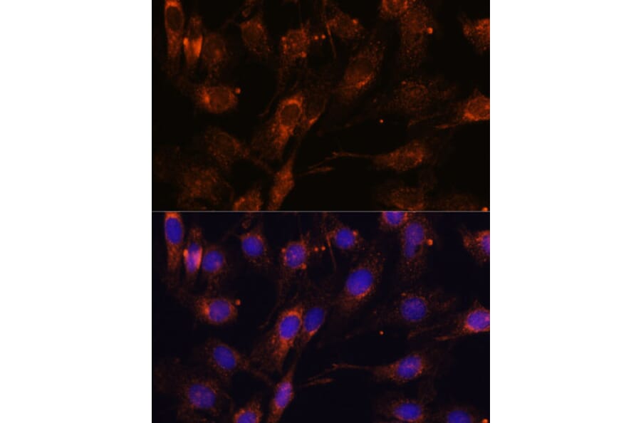 Immunofluorescence - Anti-SCAMP2/SC2 Antibody (A307710) - Antibodies.com