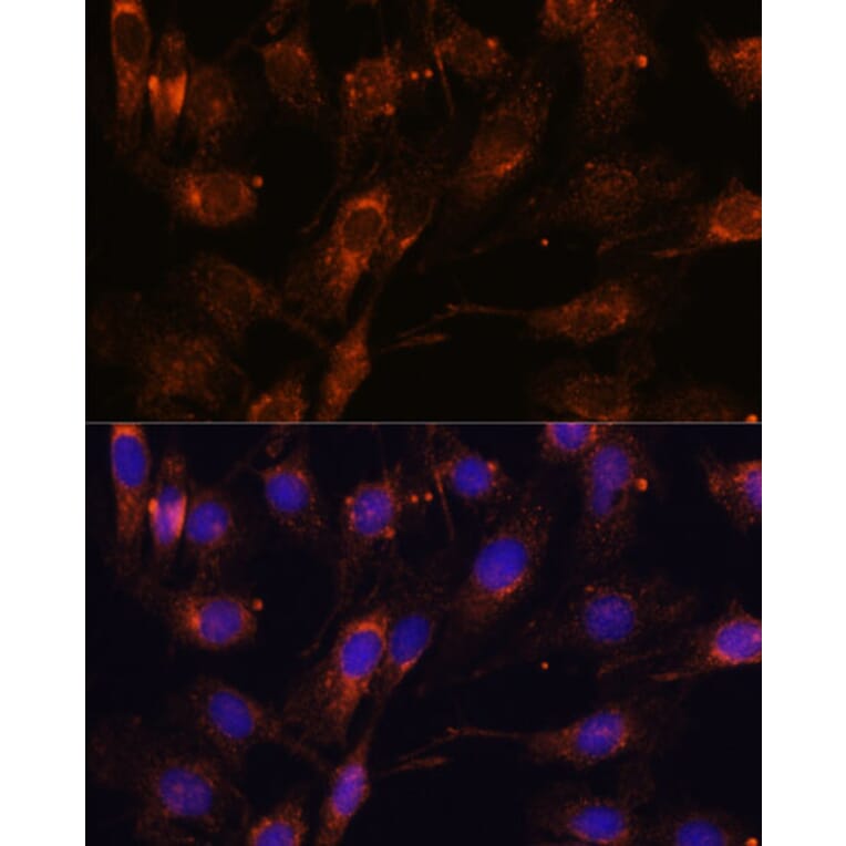 Immunofluorescence - Anti-SCAMP2/SC2 Antibody (A307710) - Antibodies.com