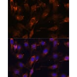 Immunofluorescence - Anti-SCAMP2/SC2 Antibody (A307710) - Antibodies.com