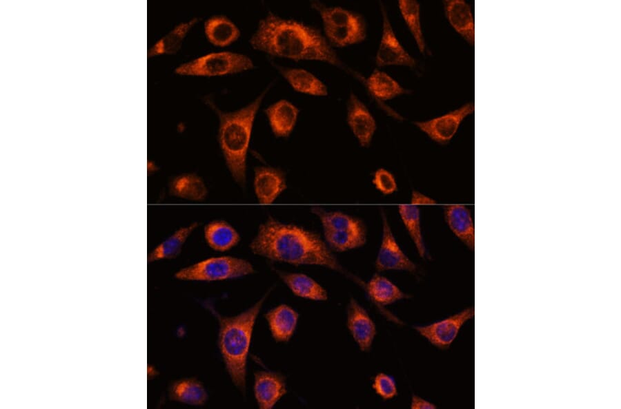 Immunofluorescence - Anti-SCAMP2/SC2 Antibody (A307710) - Antibodies.com