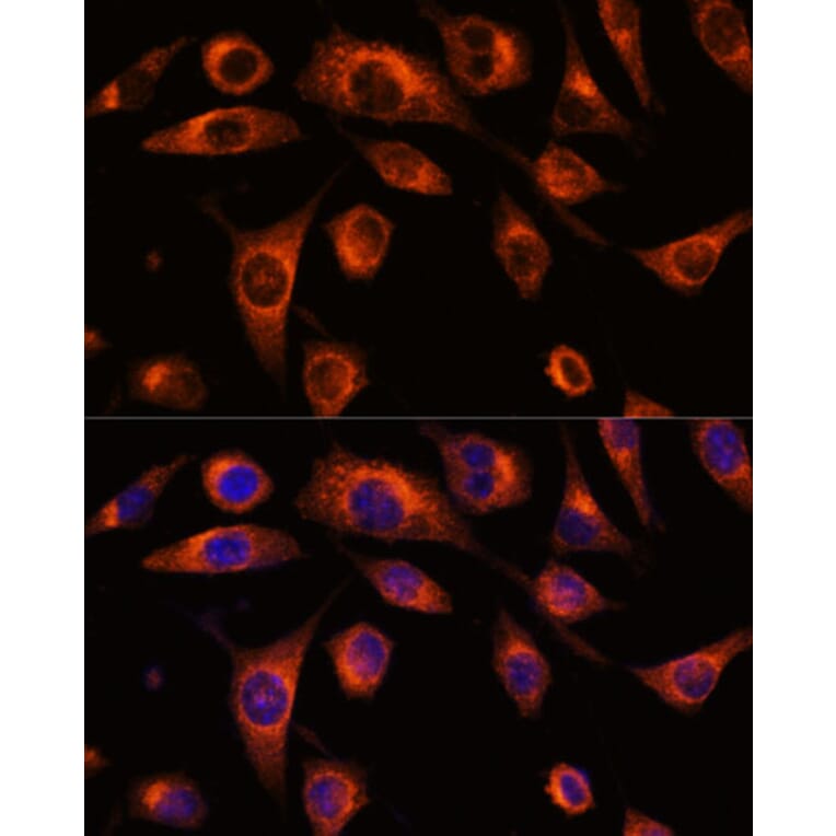 Immunofluorescence - Anti-SCAMP2/SC2 Antibody (A307710) - Antibodies.com