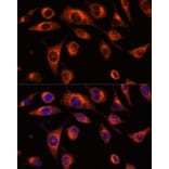 Immunofluorescence - Anti-SCAMP2/SC2 Antibody (A307710) - Antibodies.com