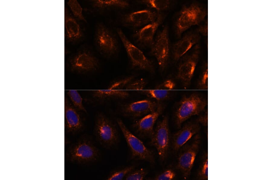 Immunofluorescence - Anti-SCAMP2/SC2 Antibody (A307710) - Antibodies.com