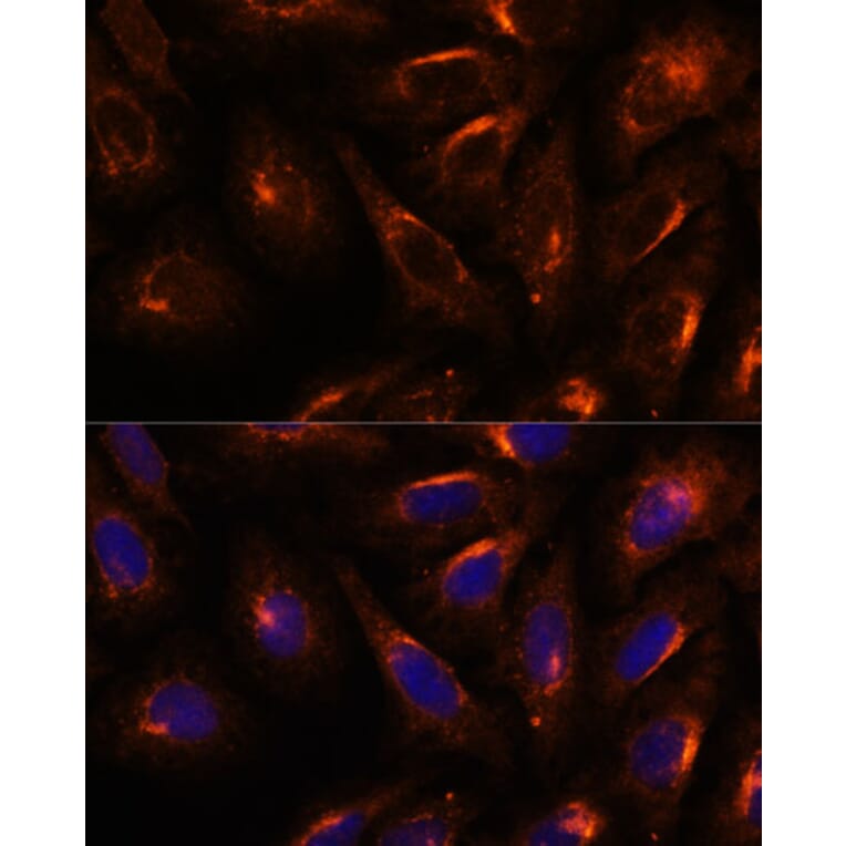 Immunofluorescence - Anti-SCAMP2/SC2 Antibody (A307710) - Antibodies.com
