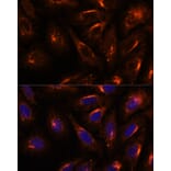 Immunofluorescence - Anti-SCAMP2/SC2 Antibody (A307710) - Antibodies.com