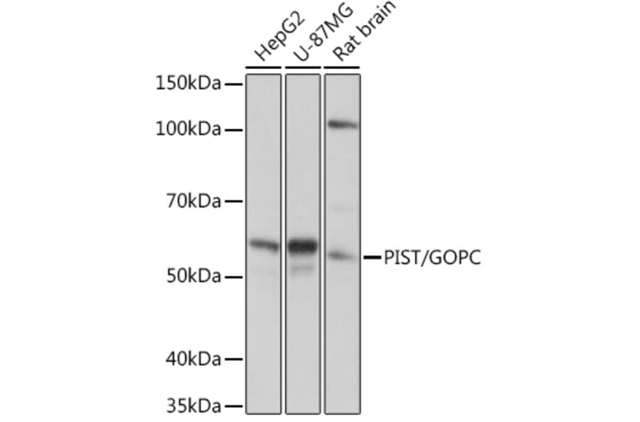 Western Blot - Anti-PIST Antibody [ARC1831] (A307711) - Antibodies.com