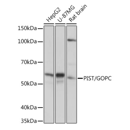 Western Blot - Anti-PIST Antibody [ARC1831] (A307711) - Antibodies.com