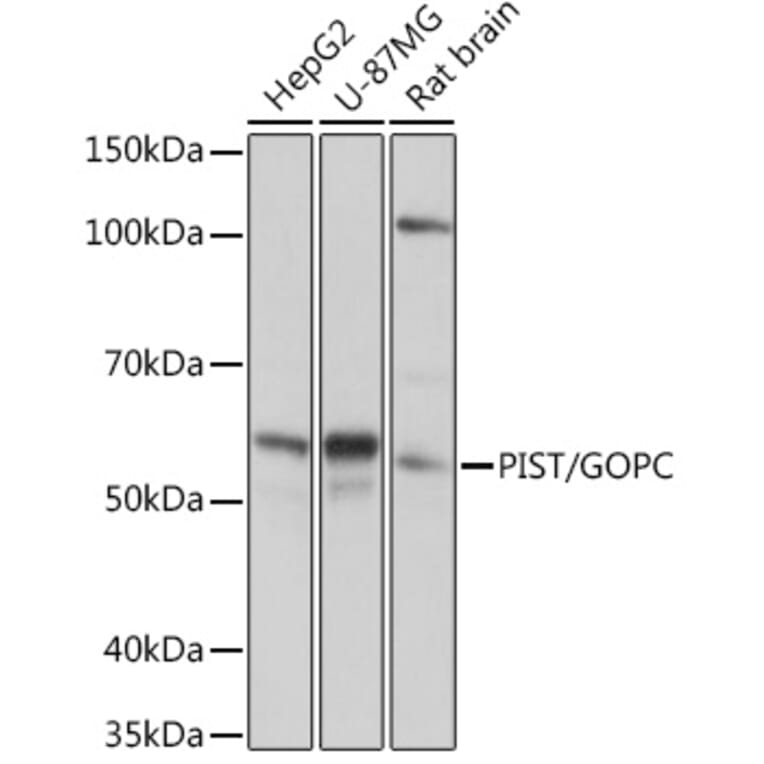 Western Blot - Anti-PIST Antibody [ARC1831] (A307711) - Antibodies.com