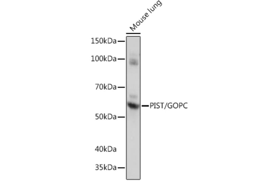 Western Blot - Anti-PIST Antibody [ARC1831] (A307711) - Antibodies.com