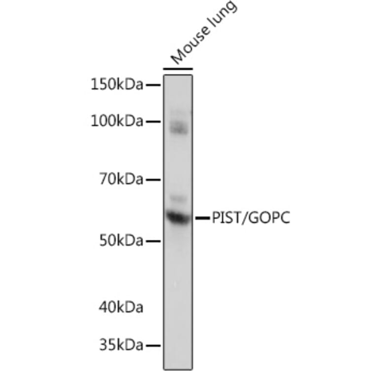 Western Blot - Anti-PIST Antibody [ARC1831] (A307711) - Antibodies.com