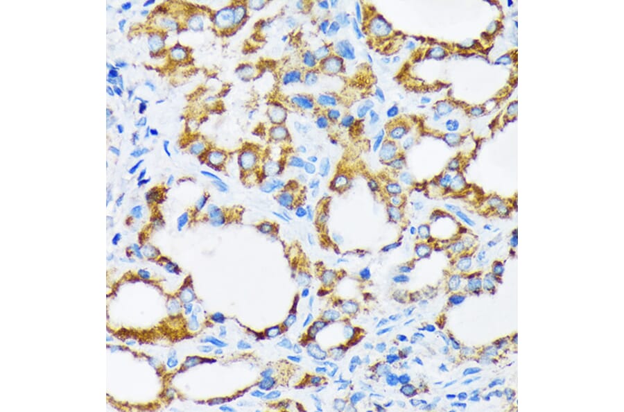 Immunohistochemistry - Anti-PIST Antibody [ARC1831] (A307711) - Antibodies.com