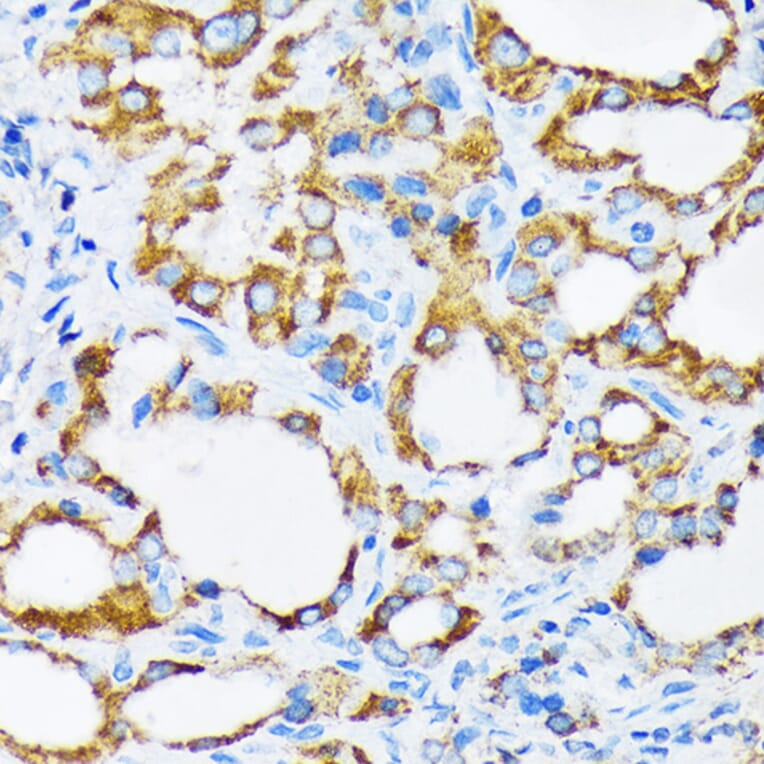 Immunohistochemistry - Anti-PIST Antibody [ARC1831] (A307711) - Antibodies.com