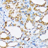 Immunohistochemistry - Anti-PIST Antibody [ARC1831] (A307711) - Antibodies.com