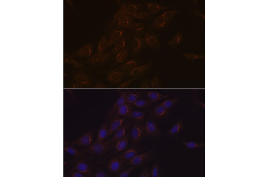 Immunofluorescence - Anti-PIST Antibody [ARC1831] (A307711) - Antibodies.com