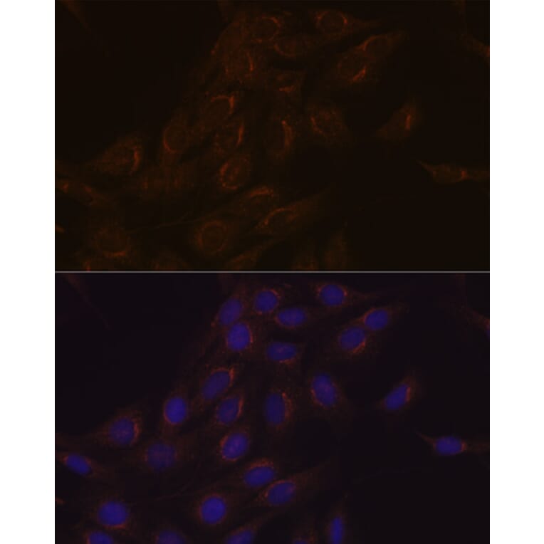 Immunofluorescence - Anti-PIST Antibody [ARC1831] (A307711) - Antibodies.com