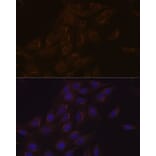 Immunofluorescence - Anti-PIST Antibody [ARC1831] (A307711) - Antibodies.com