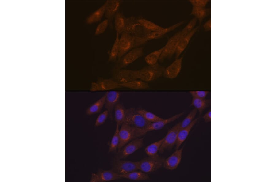Immunofluorescence - Anti-PIST Antibody [ARC1831] (A307711) - Antibodies.com