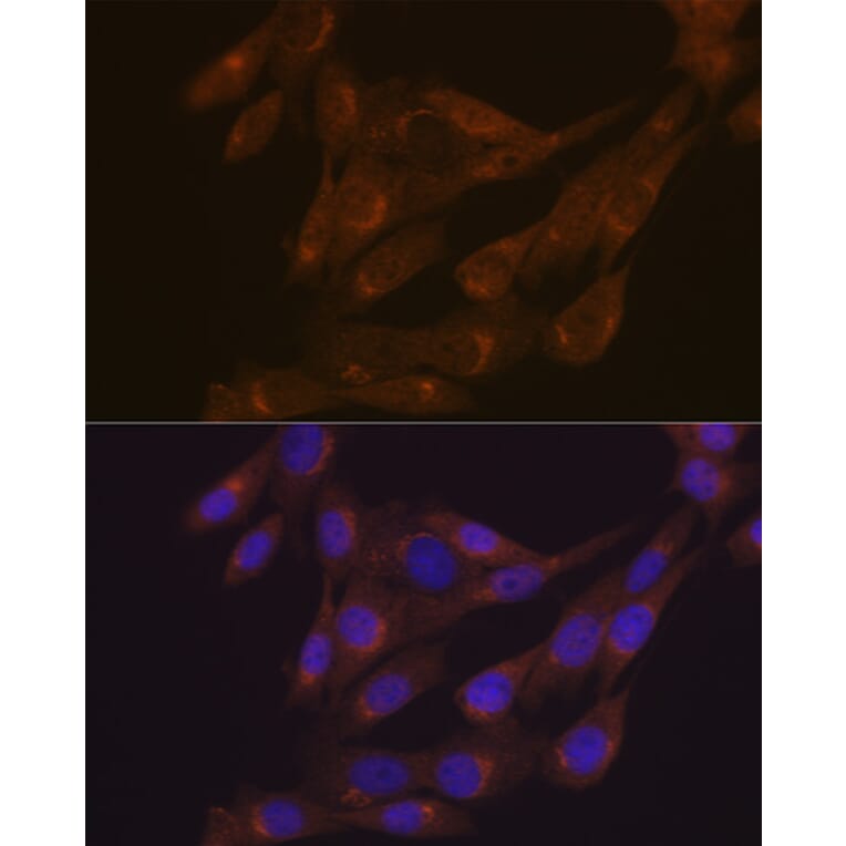 Immunofluorescence - Anti-PIST Antibody [ARC1831] (A307711) - Antibodies.com