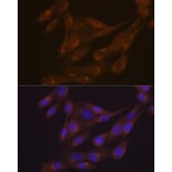 Immunofluorescence - Anti-PIST Antibody [ARC1831] (A307711) - Antibodies.com