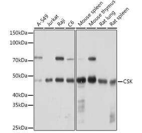 Western Blot - Anti-CSK Antibody [ARC1835] (A307712) - Antibodies.com
