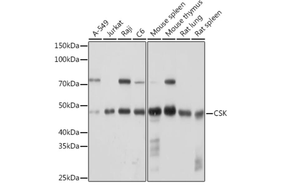 Western Blot - Anti-CSK Antibody [ARC1835] (A307712) - Antibodies.com