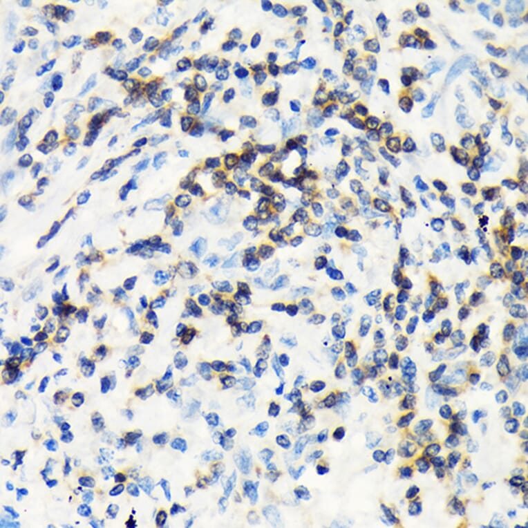 Immunohistochemistry - Anti-CSK Antibody [ARC1835] (A307712) - Antibodies.com