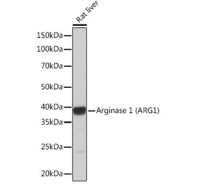 Western Blot - Anti-Liver Arginase Antibody [ARC1164] (A307713) - Antibodies.com