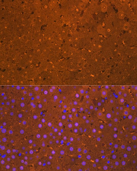 Anti-Liver Arginase Antibody [ARC1164] (A307713) | Antibodies.com