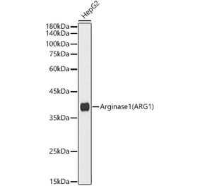 Western Blot - Anti-Liver Arginase Antibody [ARC5014-08] (A307714) - Antibodies.com