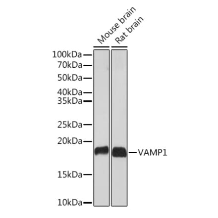 Western Blot - Anti-VAMP1 Antibody [ARC2031] (A307716) - Antibodies.com