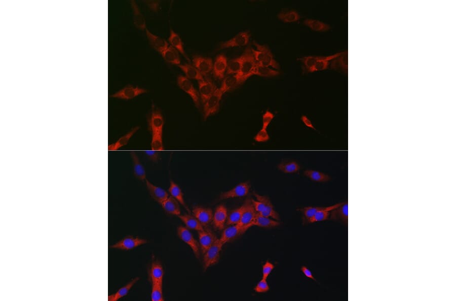 Immunofluorescence - Anti-eIF4A Antibody (A307717) - Antibodies.com