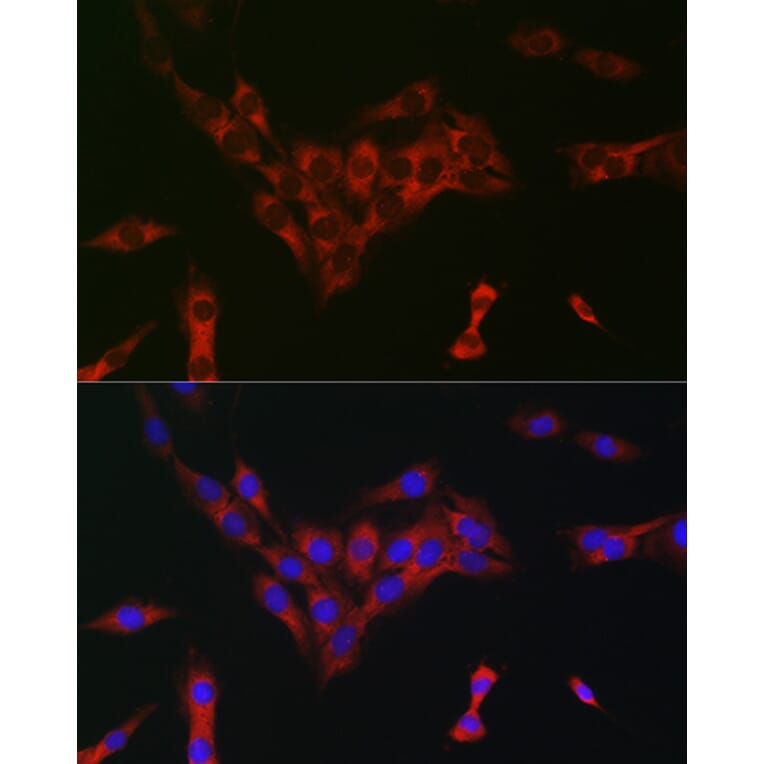 Immunofluorescence - Anti-eIF4A Antibody (A307717) - Antibodies.com
