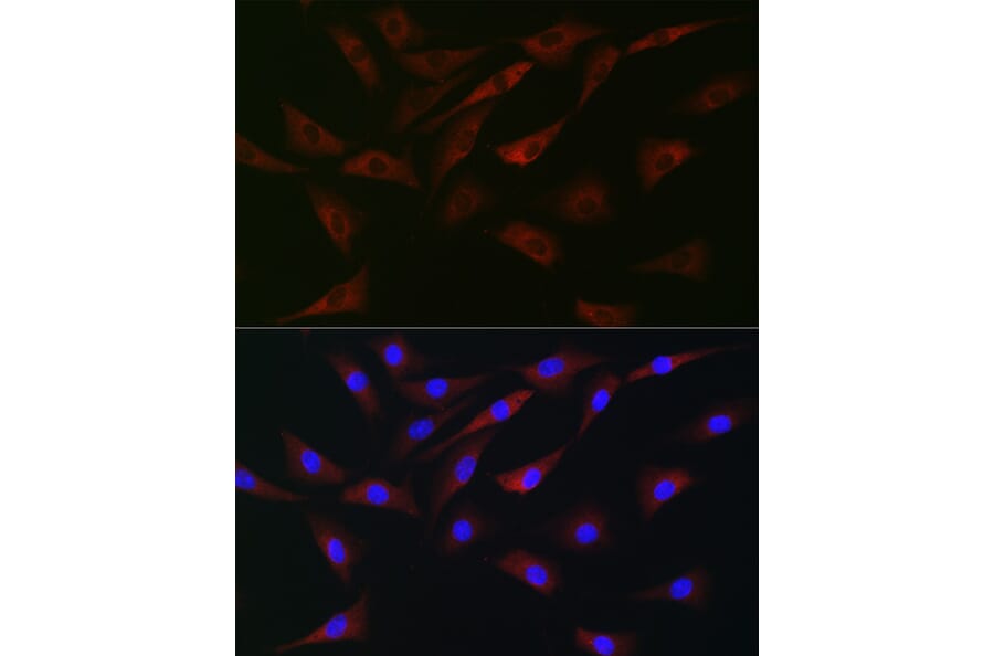 Immunofluorescence - Anti-eIF4A Antibody (A307717) - Antibodies.com