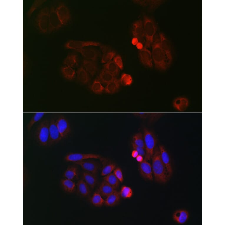 Immunofluorescence - Anti-eIF4A Antibody (A307717) - Antibodies.com