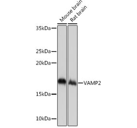 Western Blot - Anti-VAMP2 Antibody [ARC0936] (A307718) - Antibodies.com