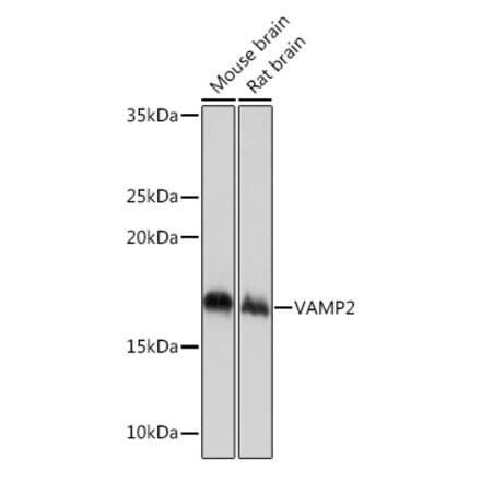 Western Blot - Anti-VAMP2 Antibody [ARC0936] (A307718) - Antibodies.com