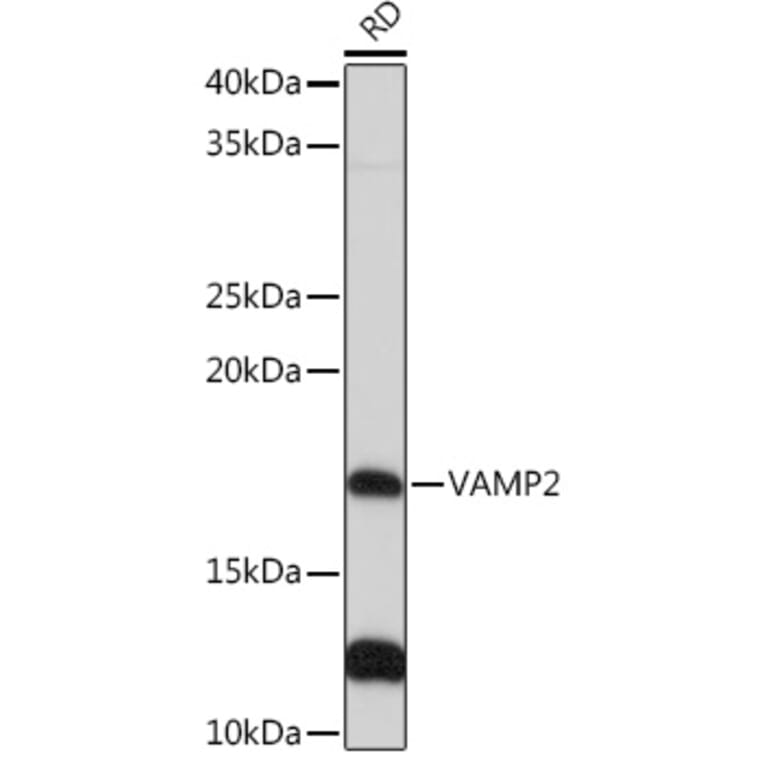 Western Blot - Anti-VAMP2 Antibody [ARC0936] (A307718) - Antibodies.com