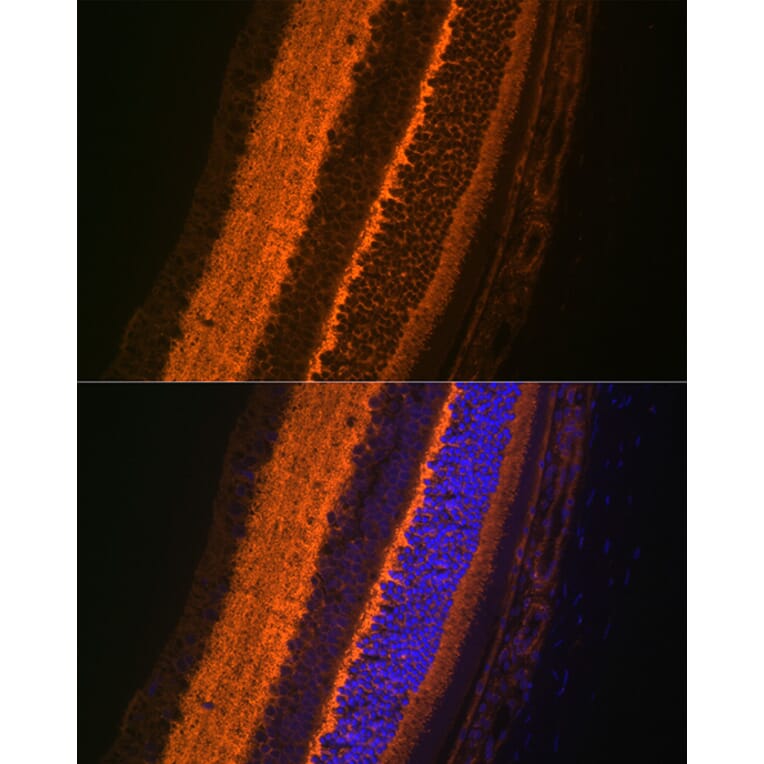 Immunofluorescence - Anti-VAMP2 Antibody [ARC0936] (A307718) - Antibodies.com