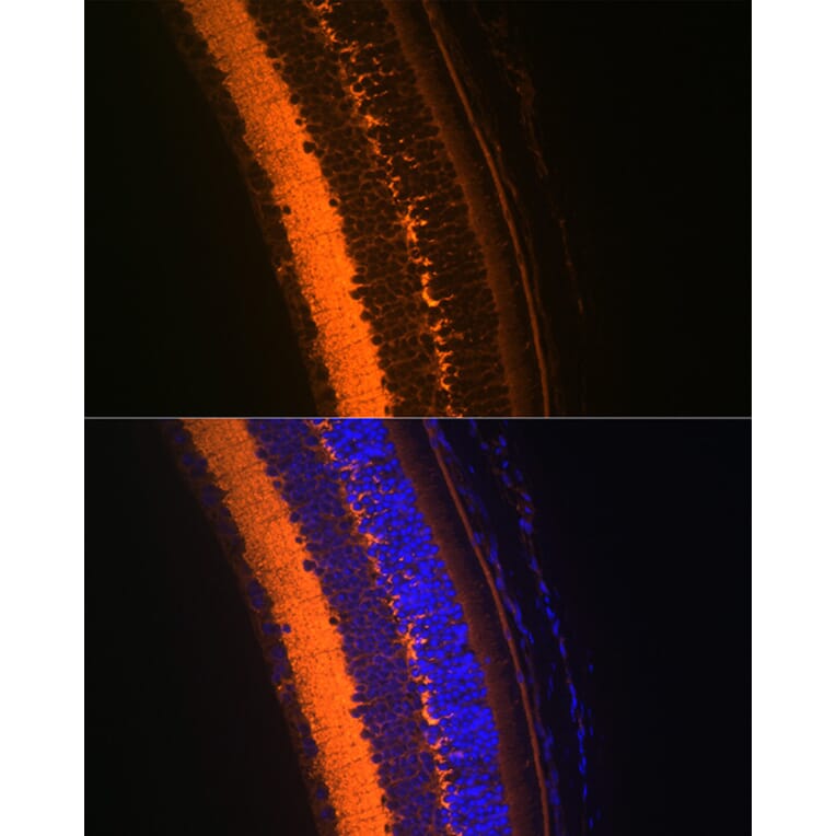 Immunofluorescence - Anti-VAMP2 Antibody [ARC0936] (A307718) - Antibodies.com