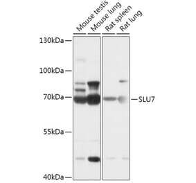 Western Blot - Anti-SLU7 Antibody (A307719) - Antibodies.com