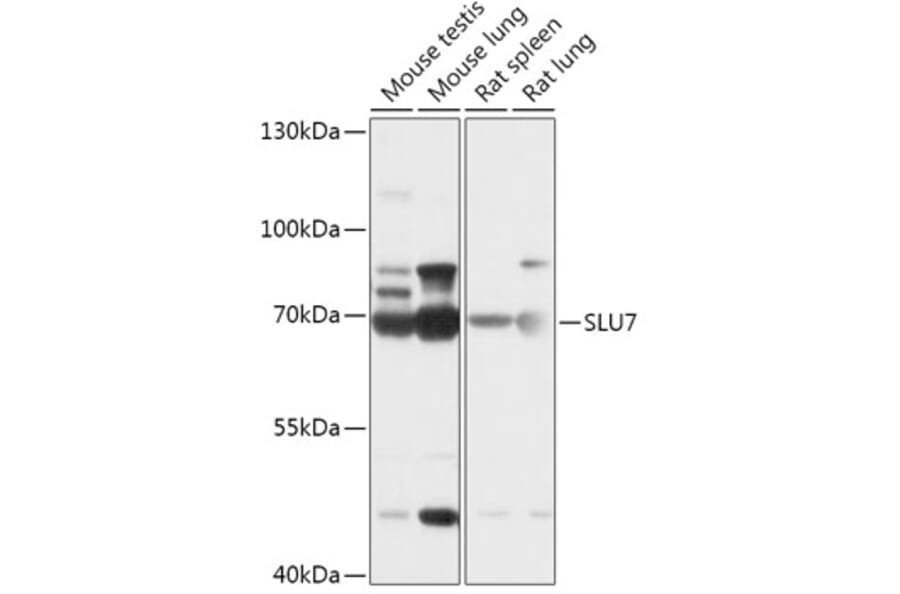Western Blot - Anti-SLU7 Antibody (A307719) - Antibodies.com